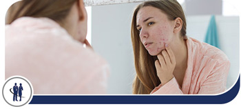 Acne Treatment Specialist Near Me in Edinburg and Mission TX